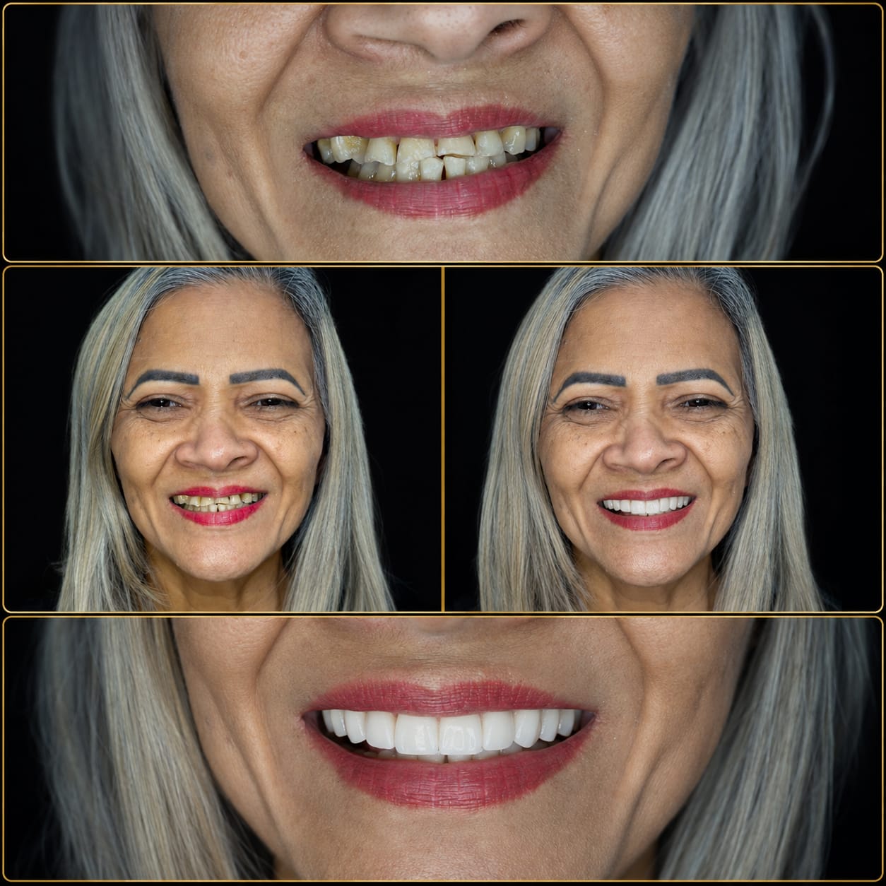 Antes e depois de tratamento estético no Hospital Vitallys